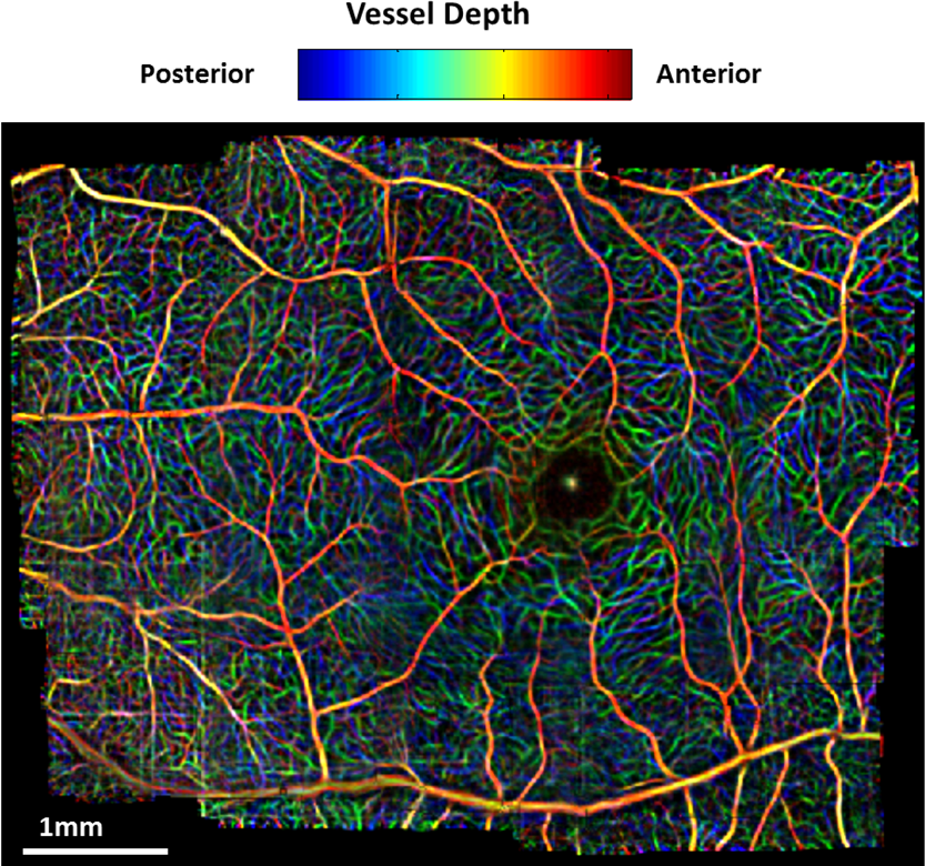 Speckle Variance Doppler Swept Source OCT Mosaic Capillary Registration 